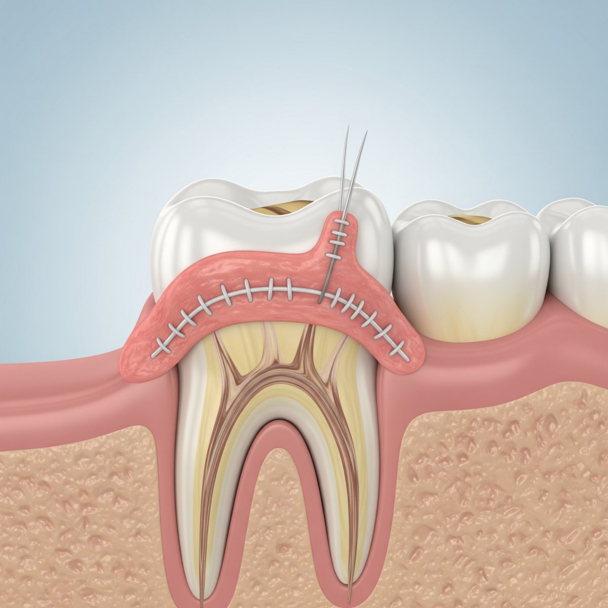 קרדיט-  תמונת AI gemini