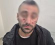 "השוטר אמר לי: מעכשיו, זה אישי": צעיר ירושלמי הוכה באכזריות בידי בלש משטרתי