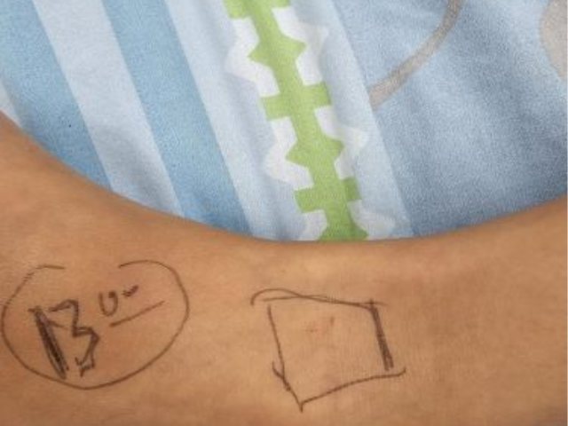 מקום ההכשה מסומן. צילום: מרכז רפואי קפלן