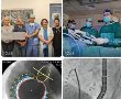 עושים היסטוריה רפואית בקפלן : לראשונה בישראל: צנתור במקום ניתוח בתיקון של המסתם הטריקוספידלי  