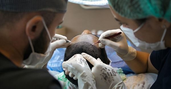 טיפול IPRF לשיער הדור החדש של טיפולי השיער הטבעיים